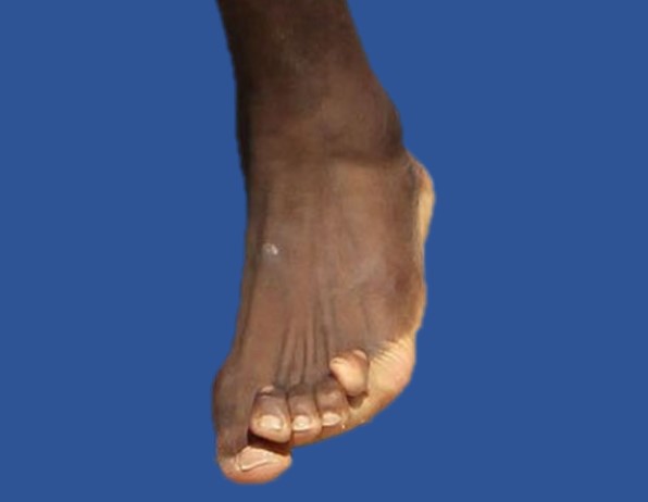 lebron james feet